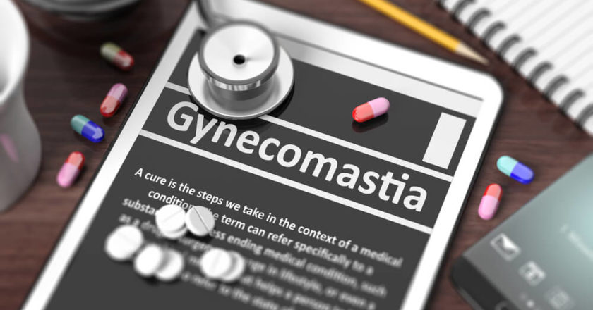 Gynecomastia lawsuits